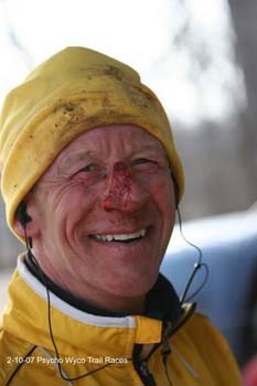 KeithDowell_bloody